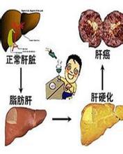 壳寡糖的护肝作用(图1)